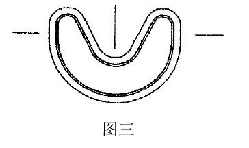 格莱圈 斯特封